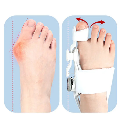 Justerbar nattspjälk för Hallux Valgus