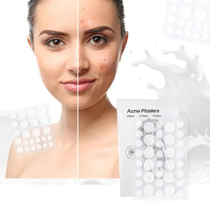 Akne Pimple Patch